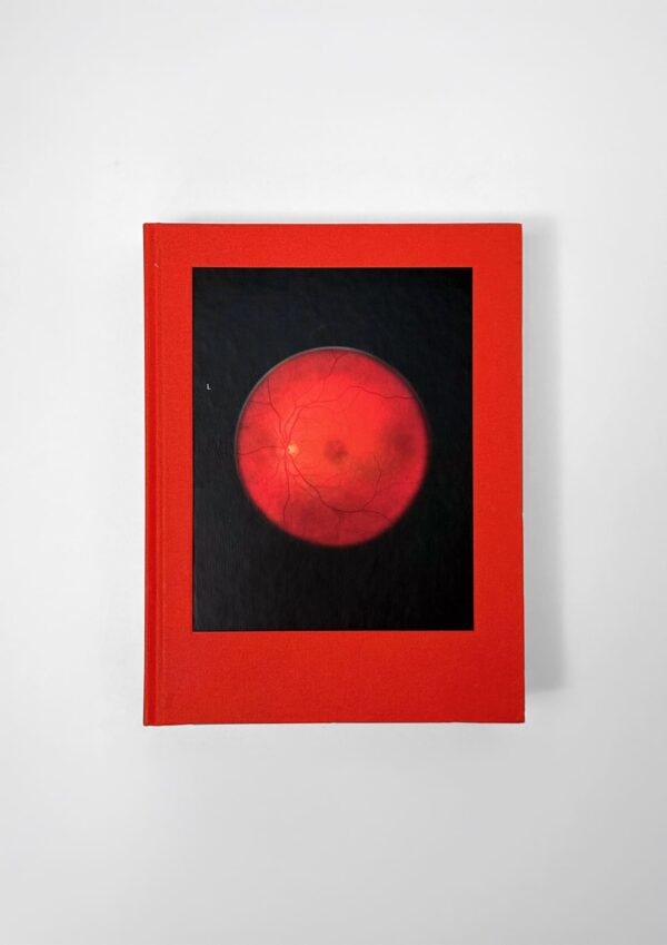 Subotzky_Retinal_Shift_1