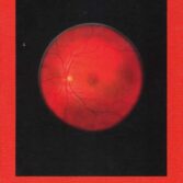 Subotzky_Retinal_Shift_Copertina